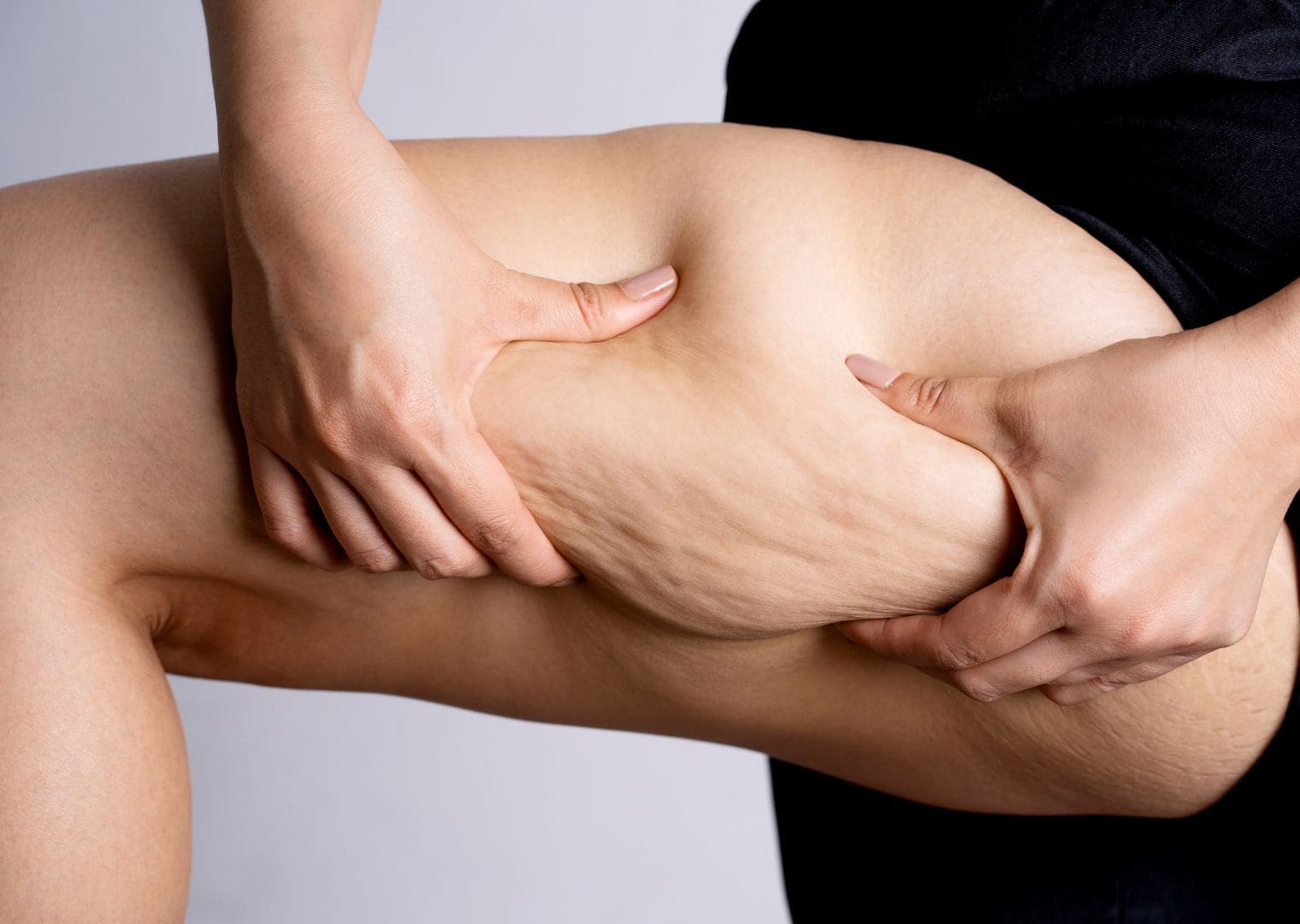 Peau raffermie sans chirurgie avec Cellu System